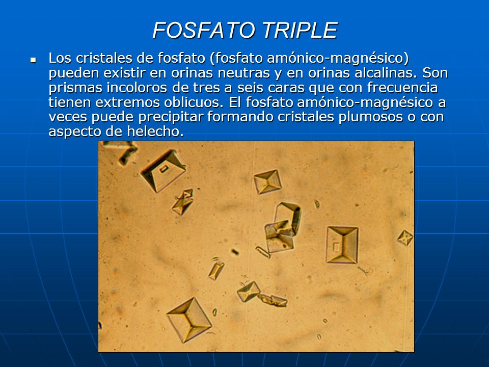 En acidas y orinas alcalinas cristales